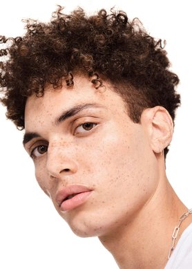 acne-e-stress-dicas-para-manter-a-calma-e-o-controlo