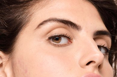 o-que-e-a-acne-hormonal-e-de-que-forma-e-que-uma-rotina-de-cuidados-da-pele-pode-ajudar