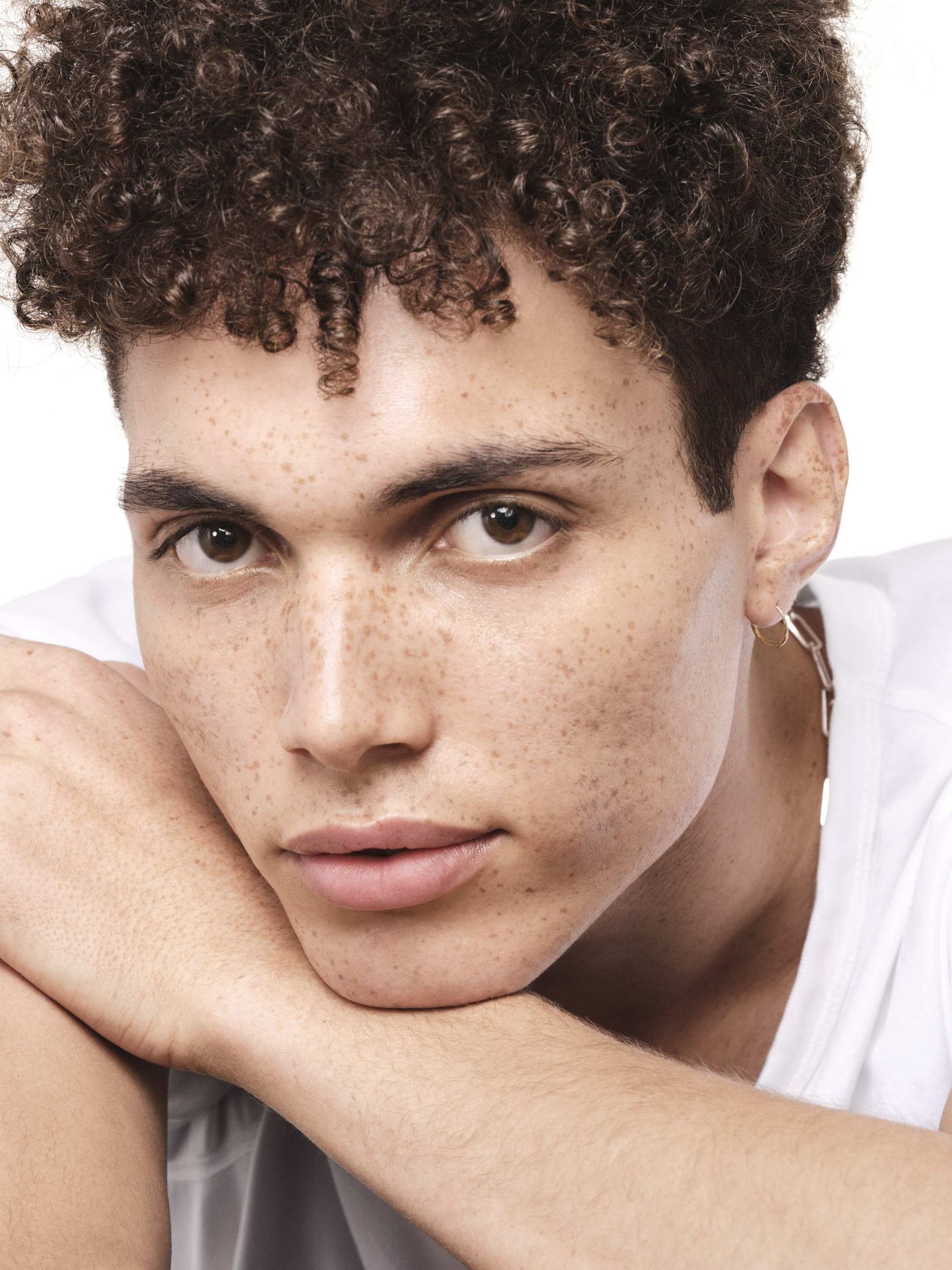 acne-durante-o-inverno-como-cuidar-da-pele-seca-com-tendencia-para-imperfeicoes