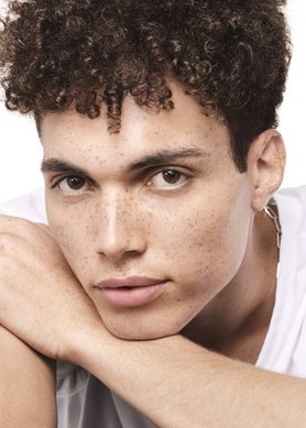 acne-durante-o-inverno-como-cuidar-da-pele-seca-com-tendencia-para-imperfeicoes