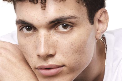 acne-durante-o-inverno-como-cuidar-da-pele-seca-com-tendencia-para-imperfeicoes