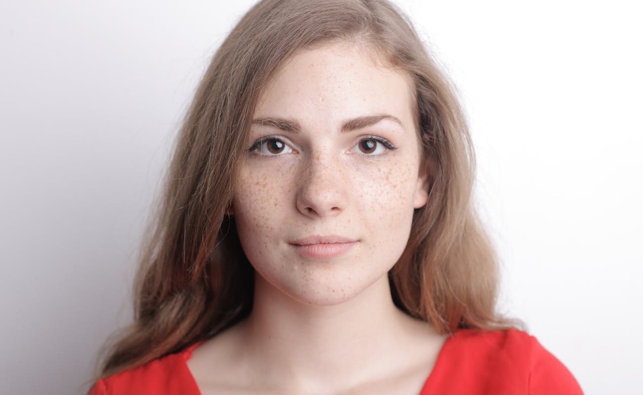 manchas castanhas na pele