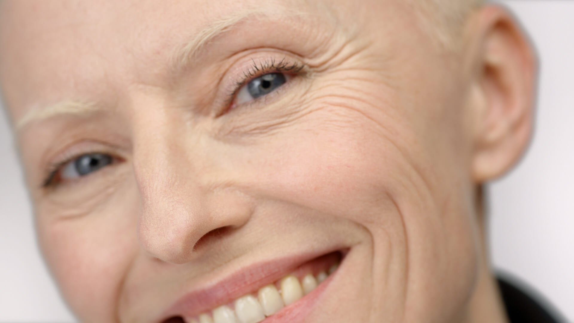 sim-a-poluicao-envelhece-a-tua-pele-descobre-porque