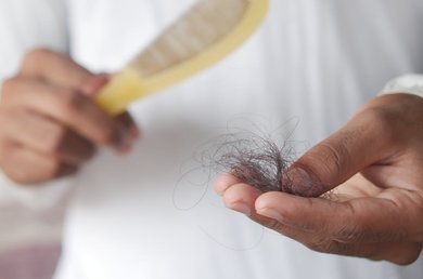 alopecia areata feminina