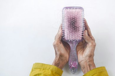 alopecia areata tratamentos