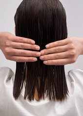 alopecia feminina