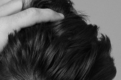 tudo-o-que-precisas-de-saber-sobre-a-caspa-aderente