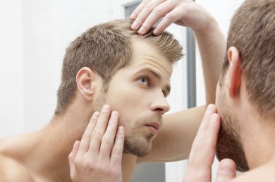 Queda de cabelo nos homens: o que fazer para evitar