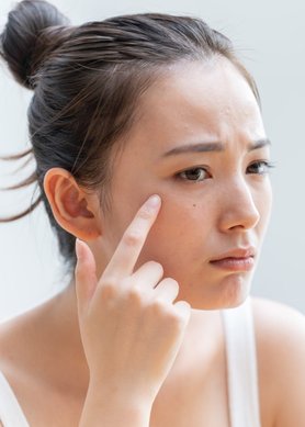 Os melhores cremes para eliminar e prevenir as manchas na pele