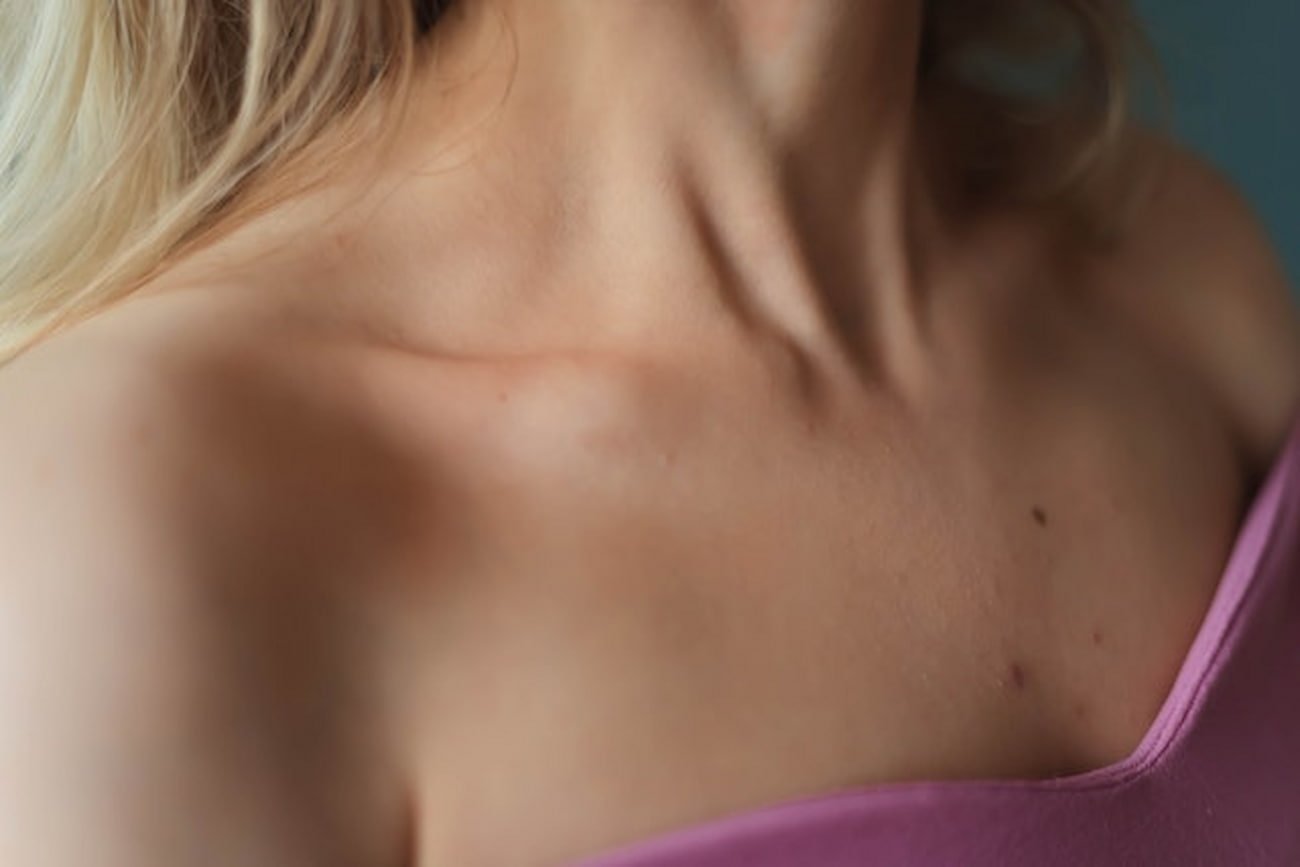 pintas vermelhas nas pernas